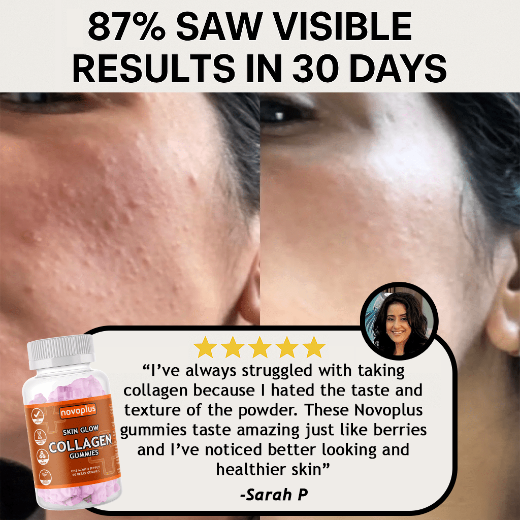 Collagen Gummies - Novoplus